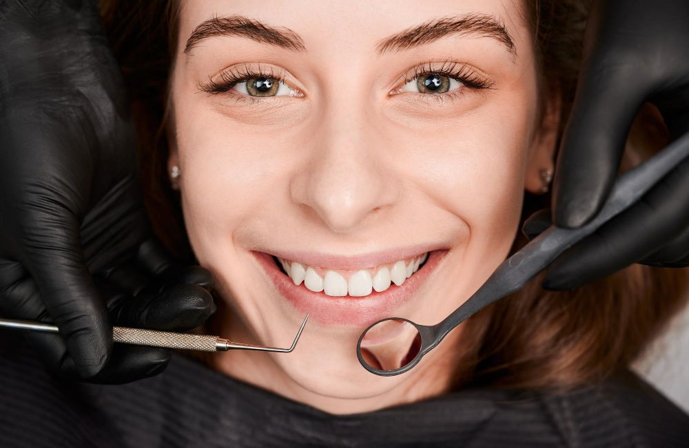 E max veneers